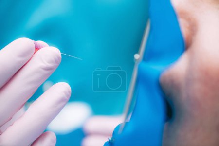 Téléchargez les photos : Un endodontiste prépare une broche barbelée pour un traitement endodontique en clinique dentaire. - en image libre de droit