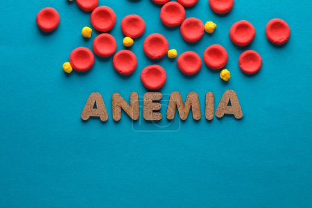 Red blood cells model and word anemia on blue background. Blood disease