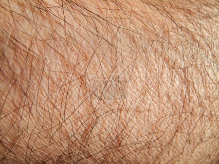 Foto de Textura de la piel humana. detalle brazo hombre. - Imagen libre de derechos