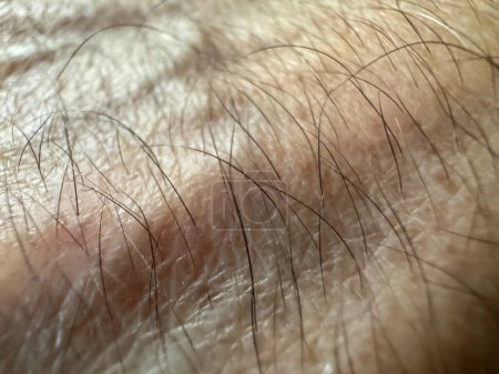 Foto de Cabello en el brazo de cerca. Textura de piel humana macro foto. Patrón de piel saludable con cabello. - Imagen libre de derechos