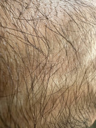 Foto de Textura de la piel humana con pelo corporal de cerca. Patrón de piel saludable con cabello macro foto. - Imagen libre de derechos