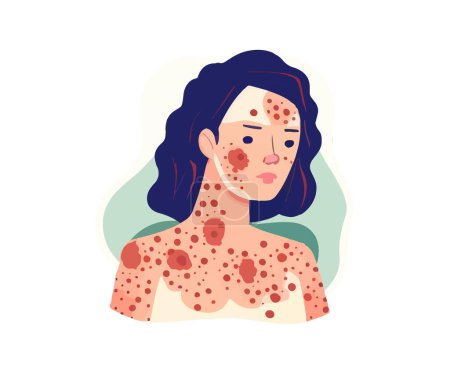 Illustration for Woman with skin disease concept. Skin rash psoriasis. Vector illustration design. - Royalty Free Image