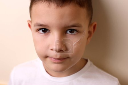 The scar on the boy's face is treated with ointment. Treatment of scars and skin pigmentation.