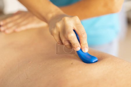 Photo for A female physiotherapist massages the back of an older man with a massage tool, a finger protector, during a manual therapy session in a clinic - Royalty Free Image