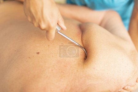 Photo for A female physiotherapist uses a hook to access the trapezius muscle on the back of an older man during a therapy session in a clinic - Royalty Free Image