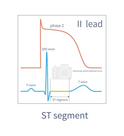Téléchargez les photos : The ST segment of the ECG is equivalent to the second phase of the ventricular muscle action potential curve, usually located on the isoelectric line. - en image libre de droit