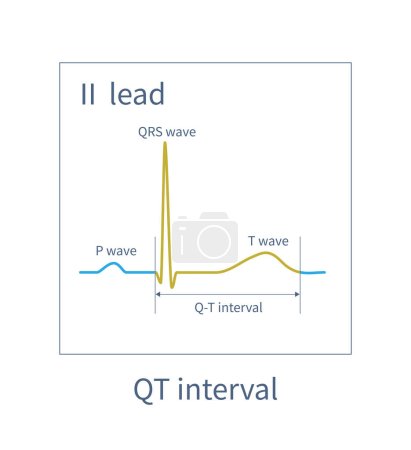 Téléchargez les photos : The QT interval of ECG is from the beginning of QRS wave to the end of T wave, representing the total time of ventricular depolarization and repolarization. - en image libre de droit