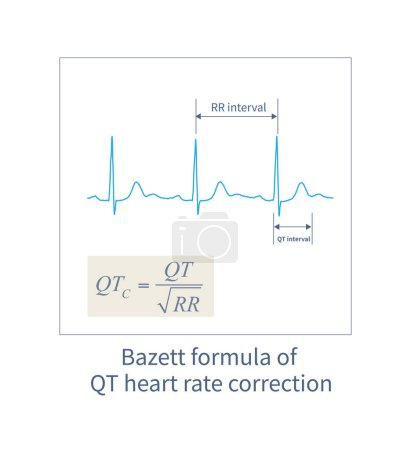 Téléchargez les photos : Heart rate can affect QT interval.The measured QT interval divided by the square root of the previous cardiac cycle is the Bazett formula for QT heart rate correction. - en image libre de droit