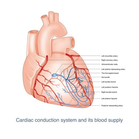 Foto de El sistema de conducción del corazón es suministrado por las ramas de la arteria coronaria. Una vez que los vasos sanguíneos están bloqueados, puede causar trastorno de conducción. Esta imagen es adecuada para fondo oscuro. Esta imagen es adecuada para fondo claro. - Imagen libre de derechos