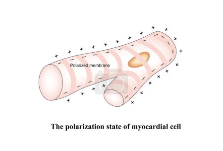 Foto de Cuando las células miocárdicas no son estimuladas, llevan cargas positivas fuera de la membrana celular y cargas negativas dentro de la membrana celular, lo que se llama un estado polarizado.. - Imagen libre de derechos