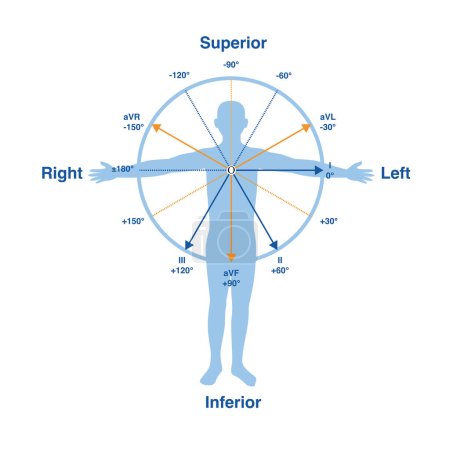 Photo for In the frontal lead system, the lead axes of the 6 limb leads form a hexaxial reference system, which is one of the important theories of electrocardiography. - Royalty Free Image