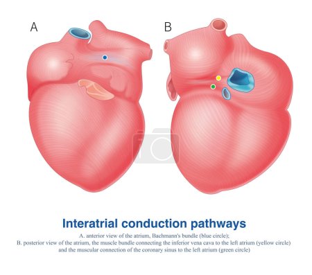 Photo for There are electrical connections in both atria anterior and posterior, with Bachmann's bundle in front and posterior atrial muscular connections in the back. - Royalty Free Image