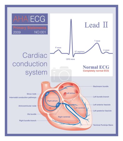 Photo for A normal ECG is an ECG that does not have any abnormal changes and can be seen in healthy people as well as in people with heart disease. - Royalty Free Image
