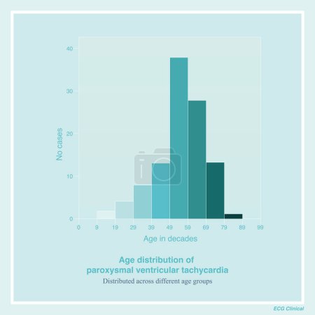 Paroxysmal ventricular tachycardia is a common clinical arrhythmia that can occur in all age groups. Figure shows the age distribution of 107 patients in a clinical ECG study.