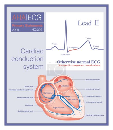 Sometimes, there may be slight non-specific changes and normal variations in the electrocardiogram, which are often due to physiological reasons and have no clinical therapeutic significance.