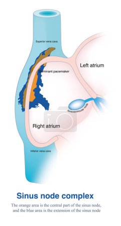 On pense que les cellules du pacemaker du noeud sinusal peuvent être distribuées le long des cristaux terminaux de l'oreillette droite dans une large zone allant de la veine cave supérieure à la veine cave inférieure..
