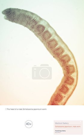 Foto de Schistosoma japonicum es un parásito que causa esquistosomiasis humana, y es predominante principalmente en Asia, causando daño al hígado humano y al sistema de las venas portales.. - Imagen libre de derechos