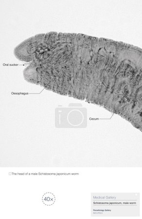 Téléchargez les photos : Schistosoma japonicum est un parasite qui provoque la schistosomiase humaine, et est principalement répandu en Asie, causant des dommages au foie humain et au système veineux porte. - en image libre de droit