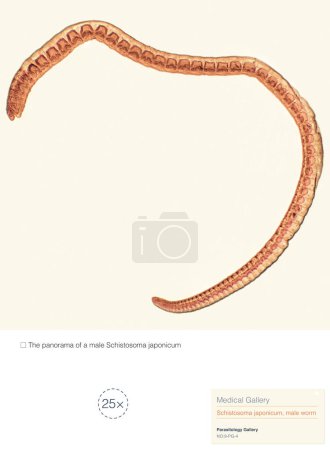 Schistosoma japonicum ist ein Parasit, der die menschliche Schistosomiasis verursacht und hauptsächlich in Asien vorkommt und Schäden an der menschlichen Leber und dem Portalvenensystem verursacht..