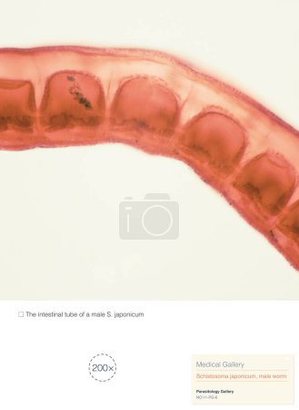 Foto de Schistosoma japonicum es un parásito que causa esquistosomiasis humana, y es predominante principalmente en Asia, causando daño al hígado humano y al sistema de las venas portales.. - Imagen libre de derechos