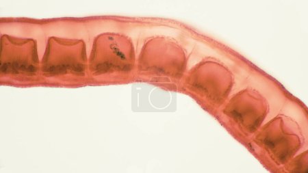 Schistosoma japonicum ist ein Parasit, der die menschliche Schistosomiasis verursacht und hauptsächlich in Asien vorkommt und Schäden an der menschlichen Leber und dem Portalvenensystem verursacht..
