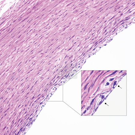 Cette photo montre de simples cellules épithéliales squameuses à la surface de la grande artère humaine, qui a les fonctions d'échange et de sécrétion.