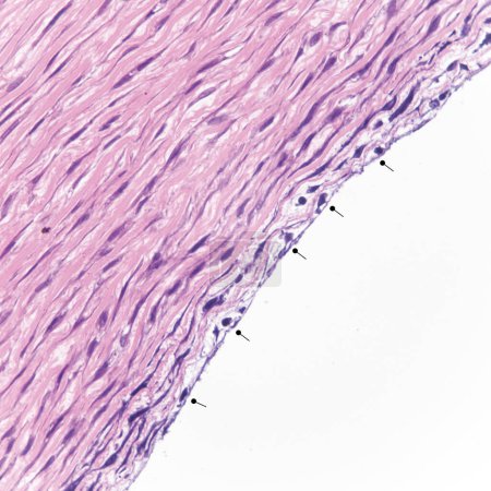 Dieses Foto zeigt einfache Plattenepithelzellen auf der Oberfläche der großen menschlichen Arterie, die die Funktionen des Austausches und der Sekretion hat.