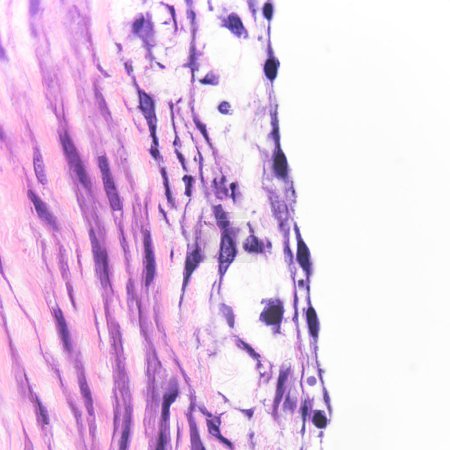 Dieses Foto zeigt einfache Plattenepithelzellen auf der Oberfläche der großen menschlichen Arterie, die die Funktionen des Austausches und der Sekretion hat. Vergrößern Sie 40x bzw. 600x.
