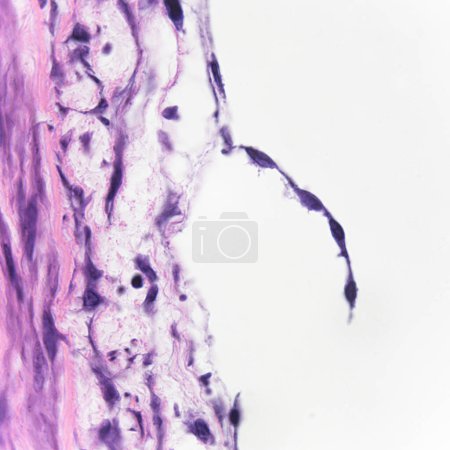 Cette photo montre de simples cellules épithéliales squameuses à la surface de la grande artère humaine, qui a les fonctions d'échange et de sécrétion. grossissent respectivement 40x et 600x.