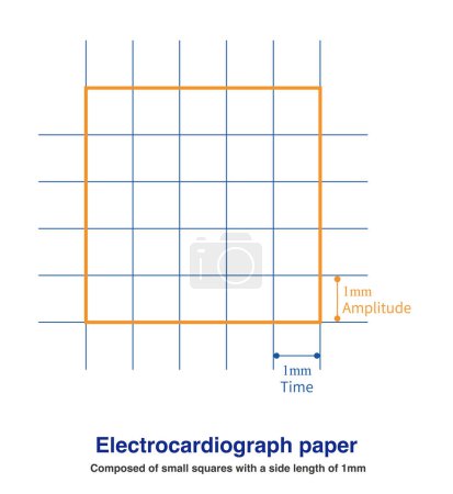 Téléchargez les photos : Le papier ECG est en fait un papier de coordonnées utilisé pour l'enregistrement, composé de petits carrés d'une longueur latérale de 1 mm, représentant le temps horizontalement et l'amplitude verticalement. - en image libre de droit