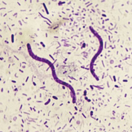 Purpurrote Spirochäten sind ein spiralförmiges Bakterium, das gramnegativ ist und im Allgemeinen anaerobe phototrophe Lebensweise durchläuft. Vergrößern 1000x