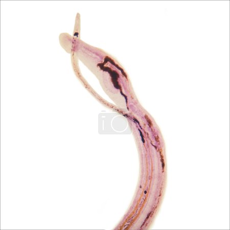 Schistosoma japonicum es un parásito que causa esquistosomiasis humana, y prevalece principalmente en Asia.Esta es una foto de un abrazo masculino y femenino, 40 veces magnificado.