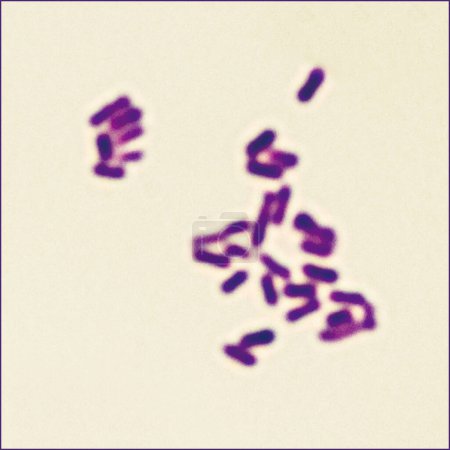 Foto de Este es el bacilo pestis, el patógeno que causó la Muerte Negra en Europa.Ampliar 1000x - Imagen libre de derechos