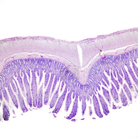 This is a histological photograph of the human small intestine. Magnify 40x.