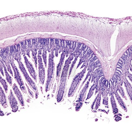 Esta es una fotografía histológica del intestino delgado humano. Aumento 40x