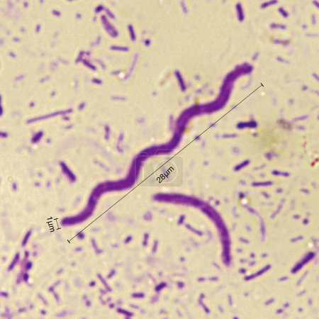 Purpurrote Spirochäten sind ein spiralförmiges Bakterium, das gramnegativ ist und im Allgemeinen anaerobe phototrophe Lebensweise durchläuft. Vergrößern 1000x