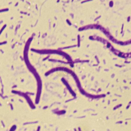 Spirochètes rouges cramoisis est une bactérie en forme de spirale qui est Gram négatif et subit généralement une vie phototrophique anaérobie.