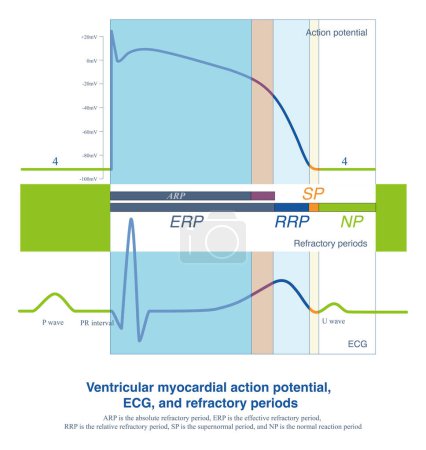 The effective refractory period of the ventricular muscle is equivalent to the time from the onset of QRS to the peak of the T wave on the ECG.