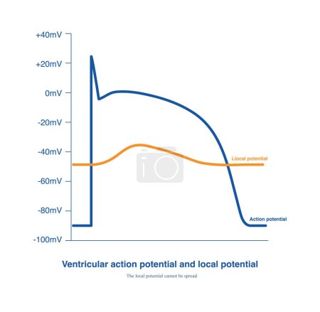 The action potential can be spread, while the local potential cannot be spread, but it can affect the subsequent propagation of the action potential.