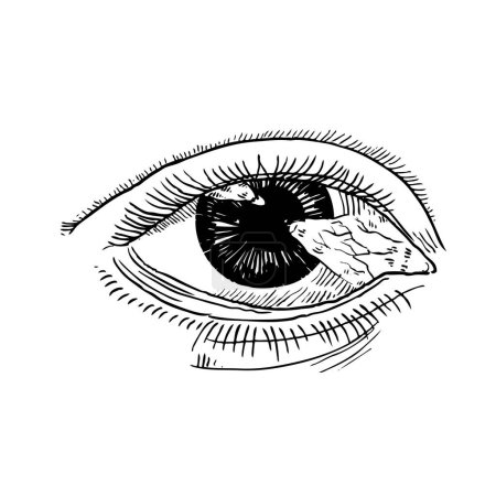 Téléchargez les illustrations : Le ptérygium pousse sur la cornée. Maladie oculaire. Illustration vectorielle de dessin à la main eps10 - en licence libre de droit