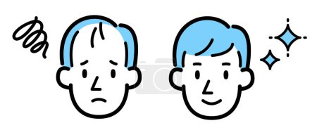 Illustration for Vector illustration of a man suffering from thinning hair and a man with fluffy hair and a smile - Royalty Free Image