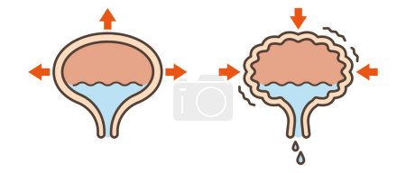 Vector illustration of organ bladder