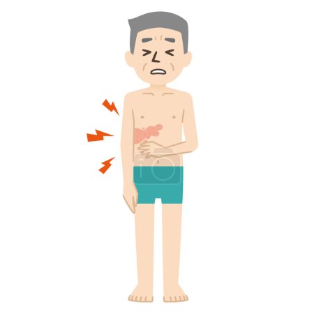 Ilustración de Ilustración vectorial de los síntomas del herpes zóster - Imagen libre de derechos
