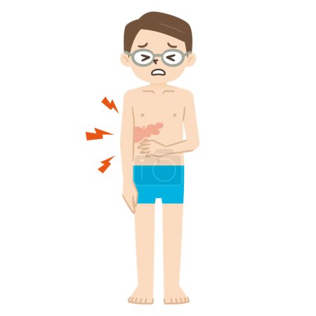 Ilustración de Ilustración vectorial de los síntomas del herpes zóster - Imagen libre de derechos