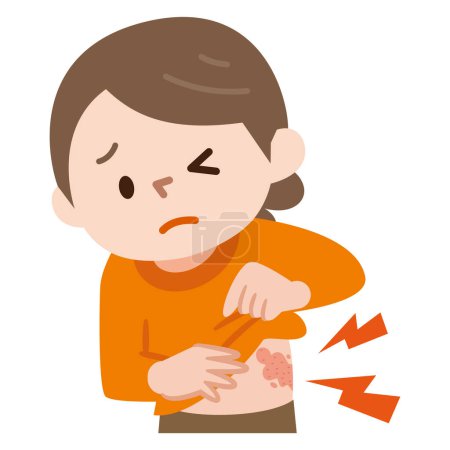 Illustration for Vector illustration of the symptoms of shingles - Royalty Free Image