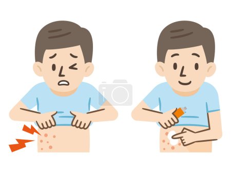 Ilustración de Ilustración vectorial de un hombre que trata el eczema con ungüento. - Imagen libre de derechos