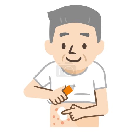 Ilustración de Ilustración vectorial de un hombre mayor aplicando medicamentos para el eczema - Imagen libre de derechos