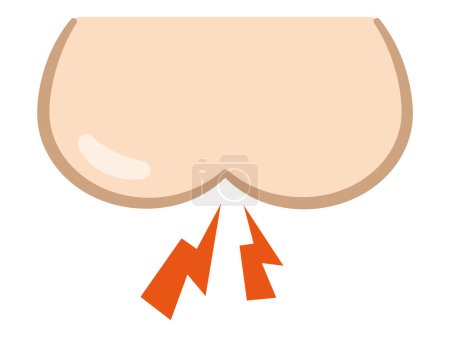 Vector illustration of a tingling butt