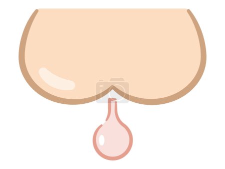 Vector illustration of butt and enema