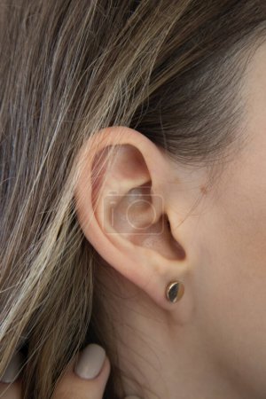 Foto de Una oreja femenina en primer plano. Oído sin lóbulo, tipo lóbulo de la oreja. Lóbulos de la oreja unidos - Imagen libre de derechos